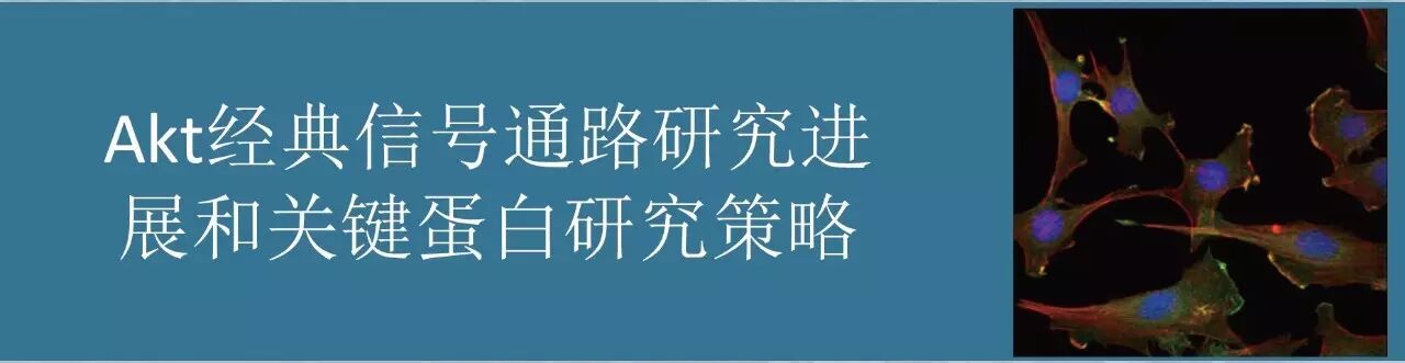 指尖上的PPT，讲述Akt的魅力故事。