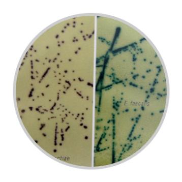 新一代B族链球菌的特异性分离显色培养基