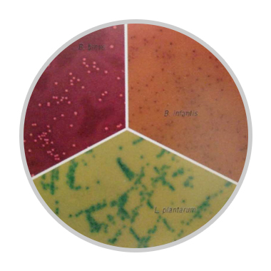 双歧杆菌——调节肠道的重要菌群（二）