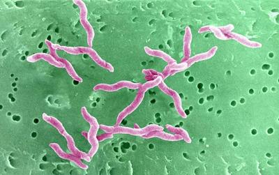 空肠弯曲菌的发病机制及传播途径