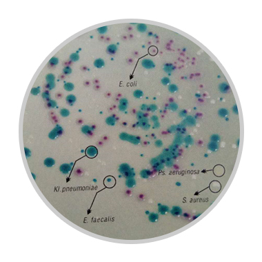 HiMedia第二代尿道感染病原菌显色培养基
