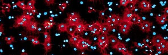 【前沿资讯】Nat Commun & Stem Cell Rep：重磅！新技术或能高效制造大脑干细胞