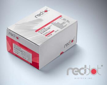 艾美捷通用多巴胺 (DA) ELISA试剂盒,体外定量帮手 艾美捷通用多巴胺 (DA) ELISA试剂盒,体外定量帮手