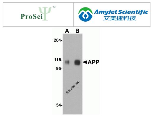 ProSci阿尔茨海默病 B-淀粉样蛋白检测套装说明书 ProSci阿尔茨海默病 B-淀粉样蛋白检测套装说明书