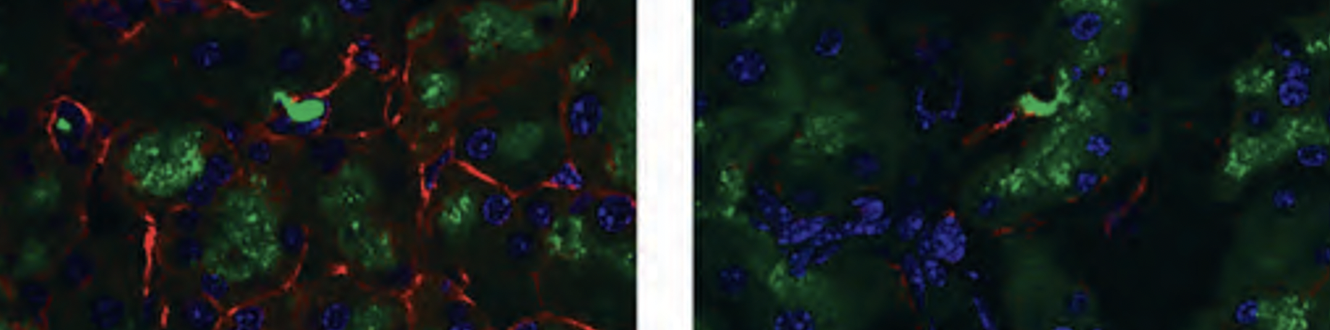 聚焦：机械敏感离子通道Piezo
