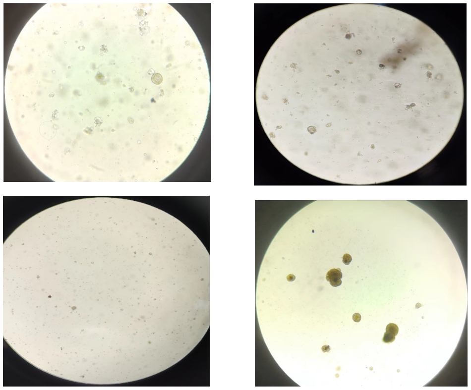 类器官传代技巧——具体情况具体分析