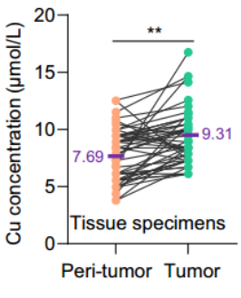 生化检测试剂盒 | 铜离子检测助力肿瘤治疗研究