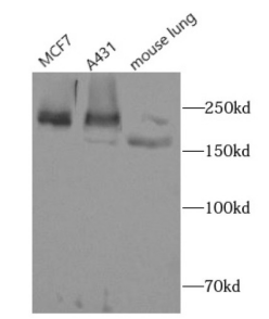 双功能3 '-5'核酸外切酶/ATP依赖性解旋酶WRN(WRN)抗体：限时抢购！