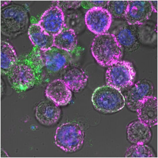 溶瘤病毒和CAR-T细胞疗法联手可有效根除实体瘤