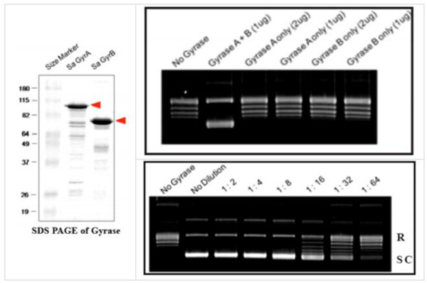 TopoGEN金h色葡萄球菌DNA旋转酶正在促销 TopoGEN金h色葡萄球菌DNA旋转酶正在促销