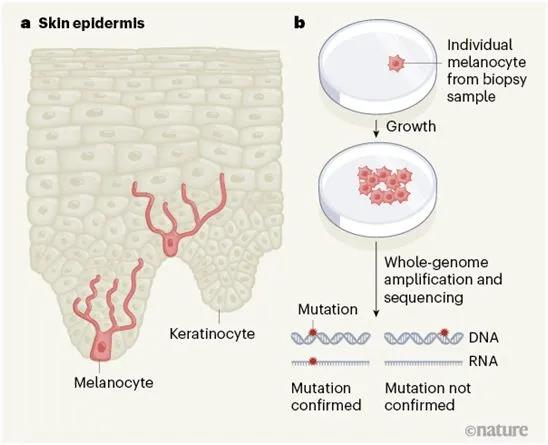 70%的黑色素瘤前体并不是由先前存在的痣产生的