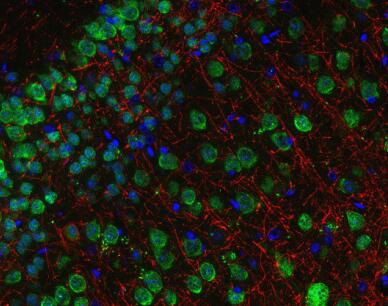 NeuN抗体丨SYSY NeuN抗体说明书及相关研究工具