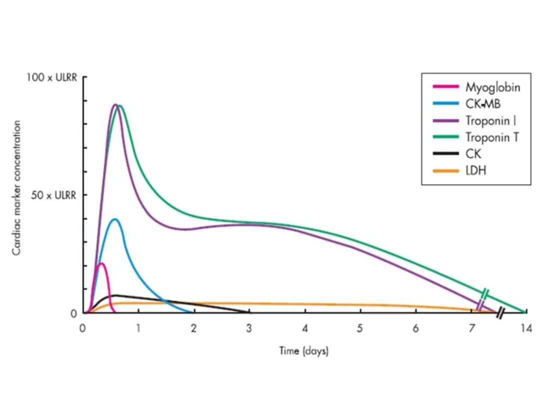 “心梗三项”查的是什么？