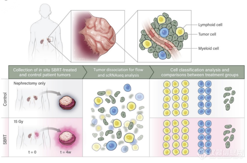 35色全光谱流式方案评估放疗对肾癌免疫微环境的影响