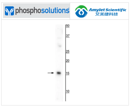 艾美捷Phosphosolutions抗 AIF1/Iba1 抗体方案 艾美捷Phosphosolutions抗 AIF1/Iba1 抗体方案
