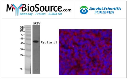 MyBioSource Cyclin E1 多克隆抗体相关研究 MyBioSource Cyclin E1 多克隆抗体相关研究