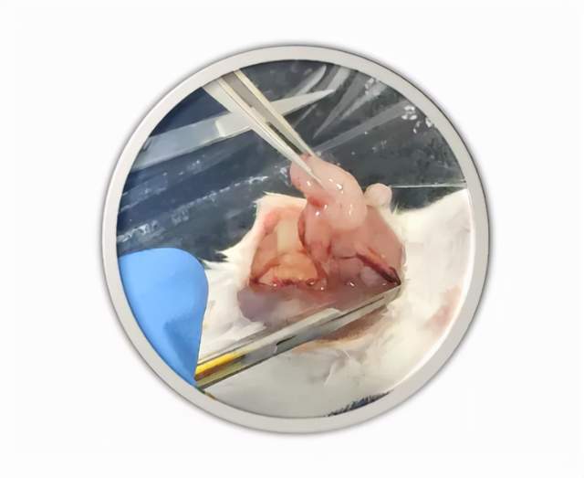 单细胞悬液制备方法︱原代细胞分离一看就会，快戳→