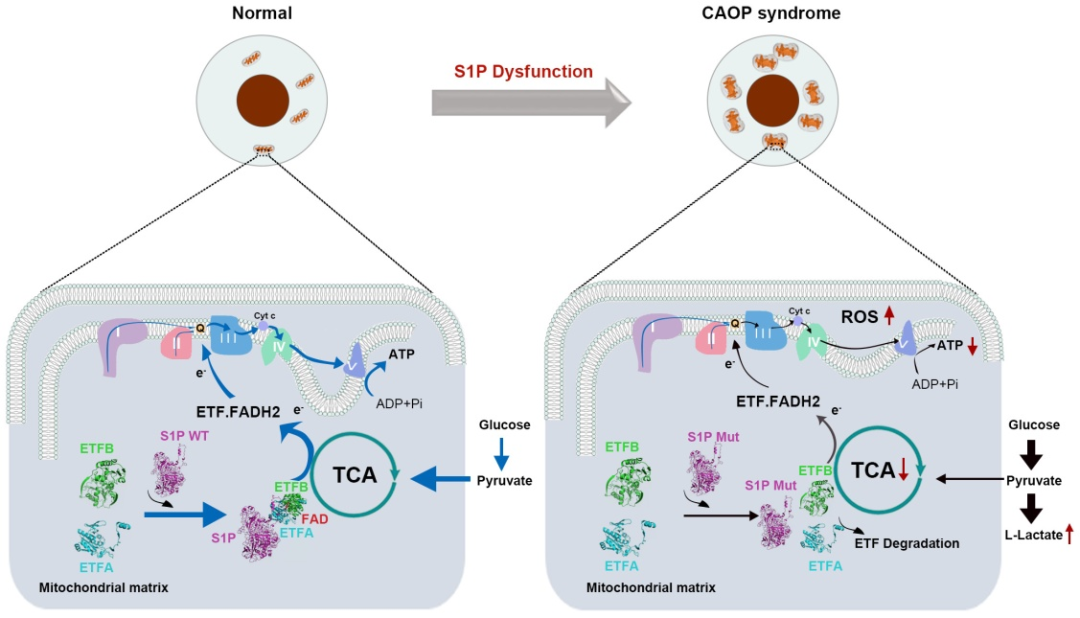 CAOP综合征的致病基因MBTPS1及其致病机制