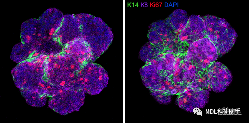 蔡车国团队揭示巨噬细胞调控乳腺干细胞活性和乳腺发育的分子机制