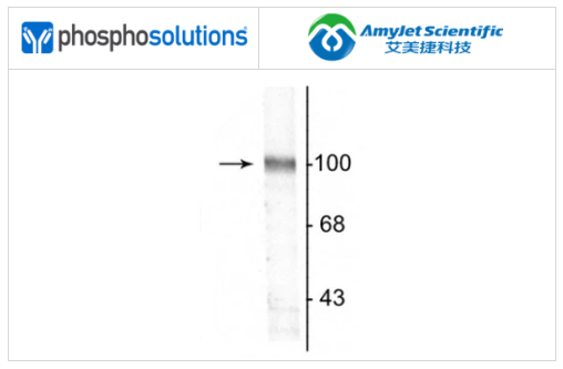 PhosphoSolutions抗GluR2抗体解决方案 PhosphoSolutions抗GluR2抗体解决方案