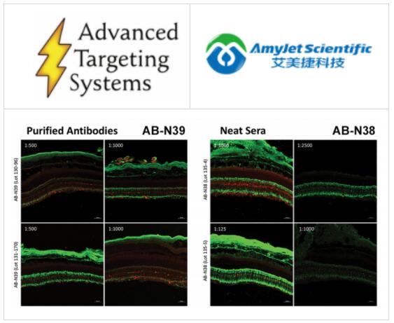 ATSbio丨艾美捷ATSbio黑色素蛋白兔多克隆抗体说明 ATSbio丨艾美捷ATSbio黑色素蛋白兔多克隆抗体说明