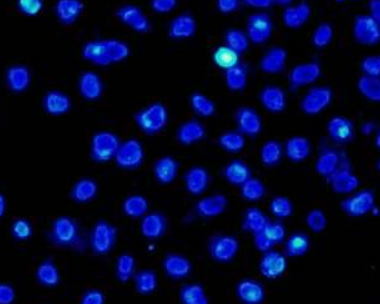 常见的细胞污染检测方法你知道几种？如何检测细胞是否被污染？