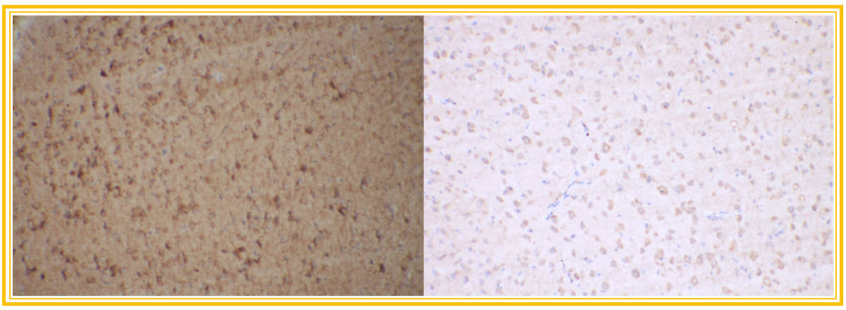 免疫组化（IHC）常见问题解析