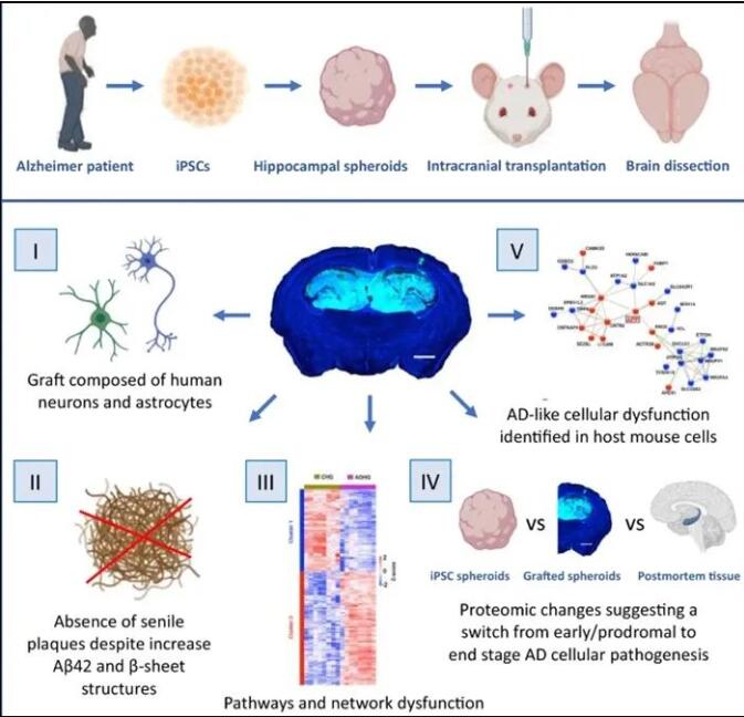 多能干细胞构建的阿尔茨海默病模型