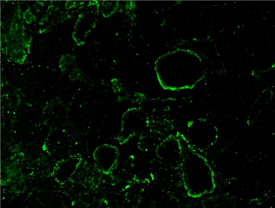 AAT Bioquest-iFluor 488刀豆蛋白A偶联物：好货不贵，省钱有道