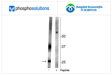 艾美捷Phosphosolutions抗水通道蛋白 2 （Ser261） 抗体