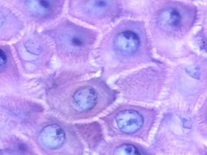 细胞百科之----鳞状上皮细胞