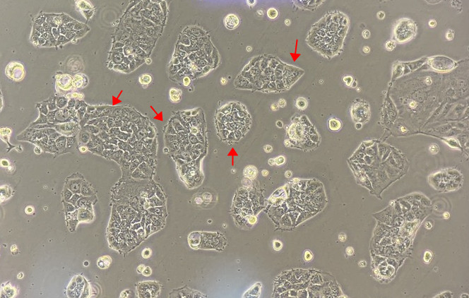 Caco-2细胞生长特性和常见问题解决策略
