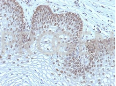 PROGEN人宫颈癌单克隆抗体-MAP3K1小鼠，EBS-T-008，纯化促销