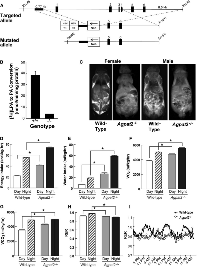 “脂肪”不要走——先天性全身性脂肪萎缩症