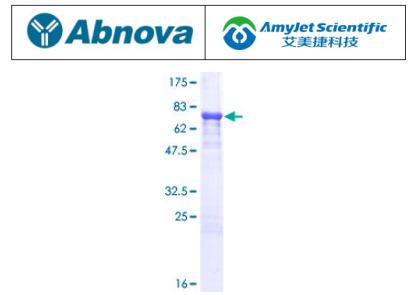 Abnova 艾美捷A1BG（人）重组蛋白（P01）说明书