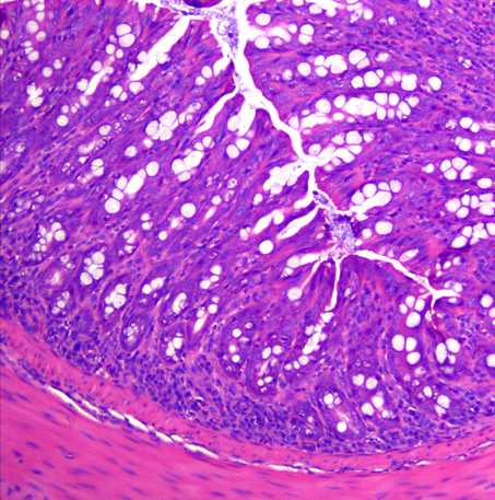 【实验详解】DSS 诱导结肠炎（结肠癌）模型制备
