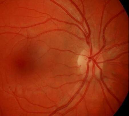 眼睛传送到大脑的视神经区域中发现了干细胞