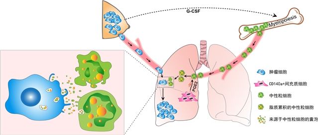 预转移微环境中的免疫细胞作为肿瘤细胞能量供应源这一新功能