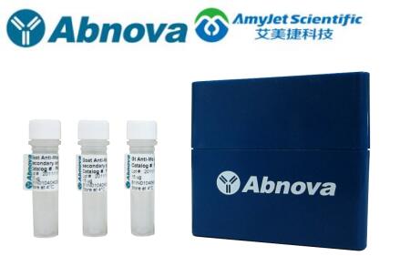 Abnova腹部肿瘤 FFPE 组织载玻片参数说明 Abnova腹部肿瘤 FFPE 组织载玻片参数说明