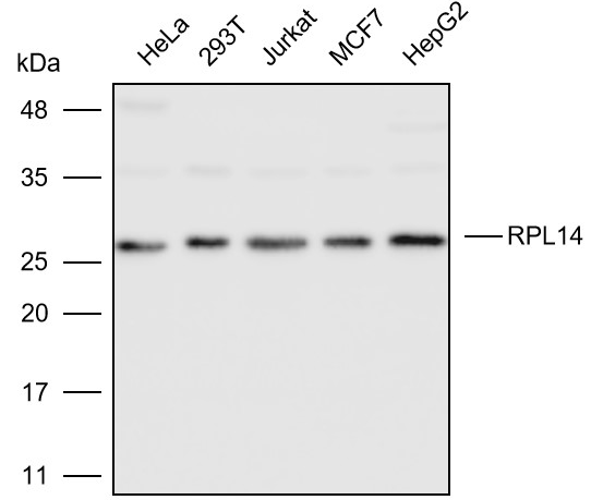 抗体产品星推荐第九期|Anti-RPL14 Polyclonal Antibody