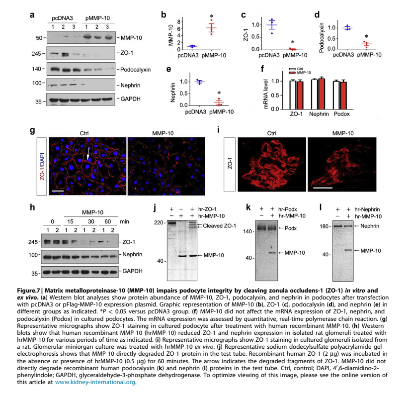 MMP10-新的足细胞损伤介导分子