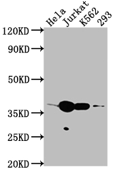 Epigentek-CDK6重组单克隆抗体[8G3]促销风暴来袭！