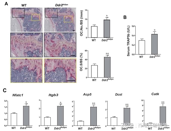 图4. Ddr2Adip小鼠的骨吸收得到促进