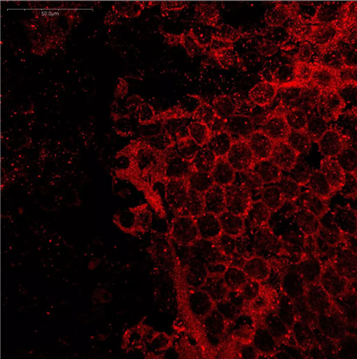 Immusmol-L-色氨酸抗体-小鼠单克隆抗体（mAb）现货促销，提升实验室采购效率