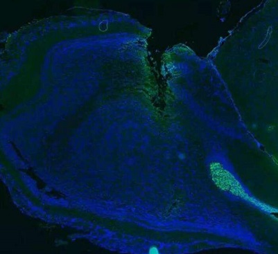利用大脑中的内源性干细胞来修复脑损伤