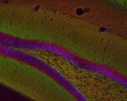 VGLUT 1抗体丨SYSY VGLUT 1抗体化学性质和文献参考 VGLUT 1抗体丨SYSY VGLUT 1抗体化学性质和文献参考