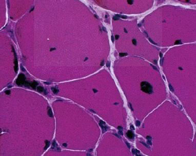 HE染色的实验原理方法及注意事项