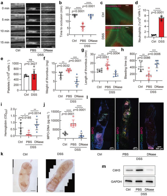 外泌体提取鉴定 外泌体提取鉴定