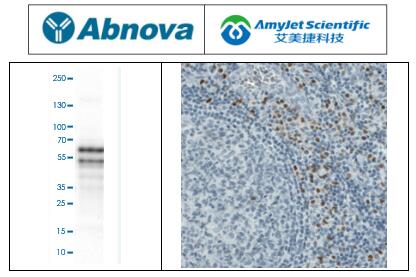 说明书丨Abnova艾美捷RUNX2 单克隆抗体