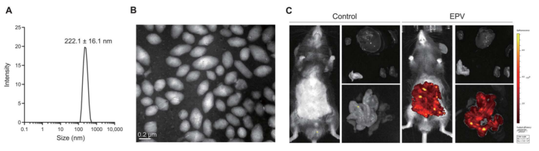 Science子刊：肠道靶向纳米颗粒可针对产气荚膜梭菌感染提供特异性靶向抗菌肽